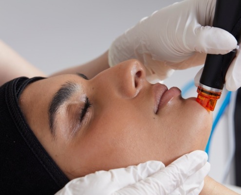 Hydrafacial